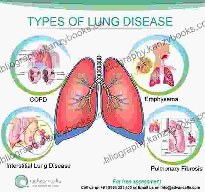 Chronic Respiratory Diseases, Affecting The Airways And Lungs Top Common Diseases: By Knowledge Flow