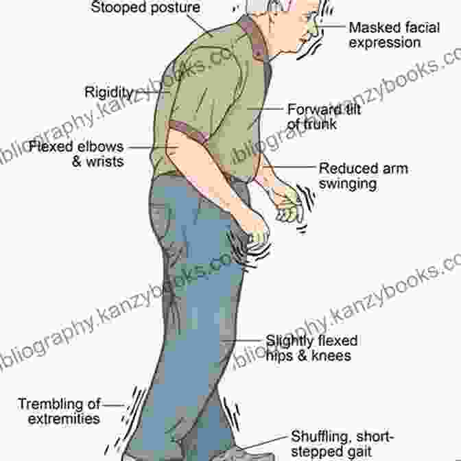 Image Of A Parkinson's Patient Before And After Using Pepper's Approach Reverse Parkinson S Disease John Pepper