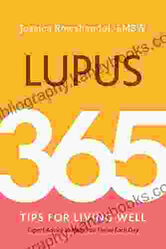 Lupus: 365 Tips For Living Well